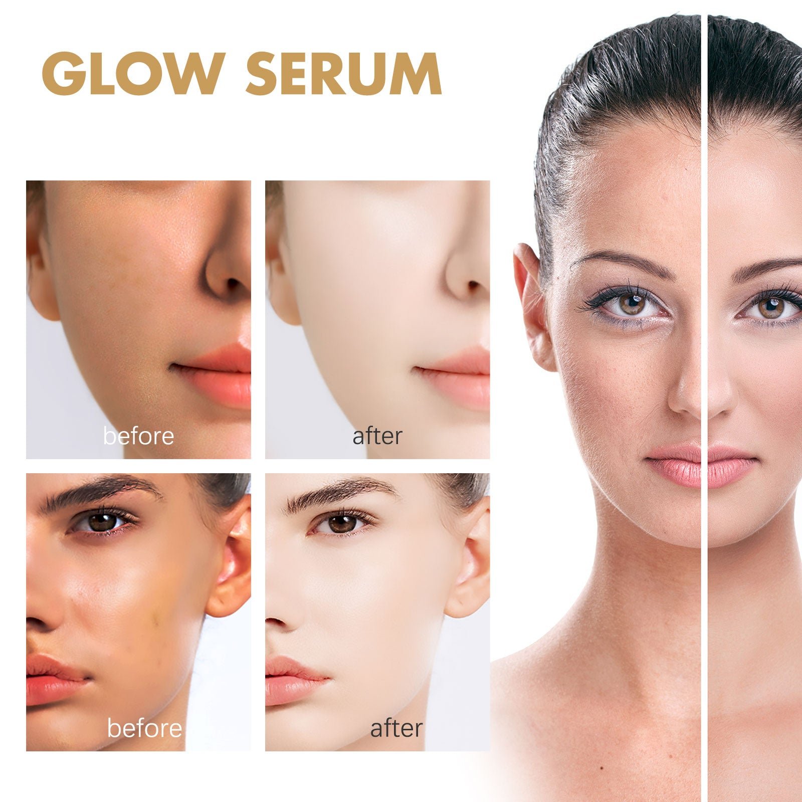 EELHOE Propolis Nicotinamide Photosensitive Essence, Reduces Acne Marks Moisturizes Brightens And Whitens Facial Essence